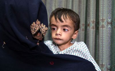 Enfant souffrant de malnutrition en Afghanistan accompagné de sa mère