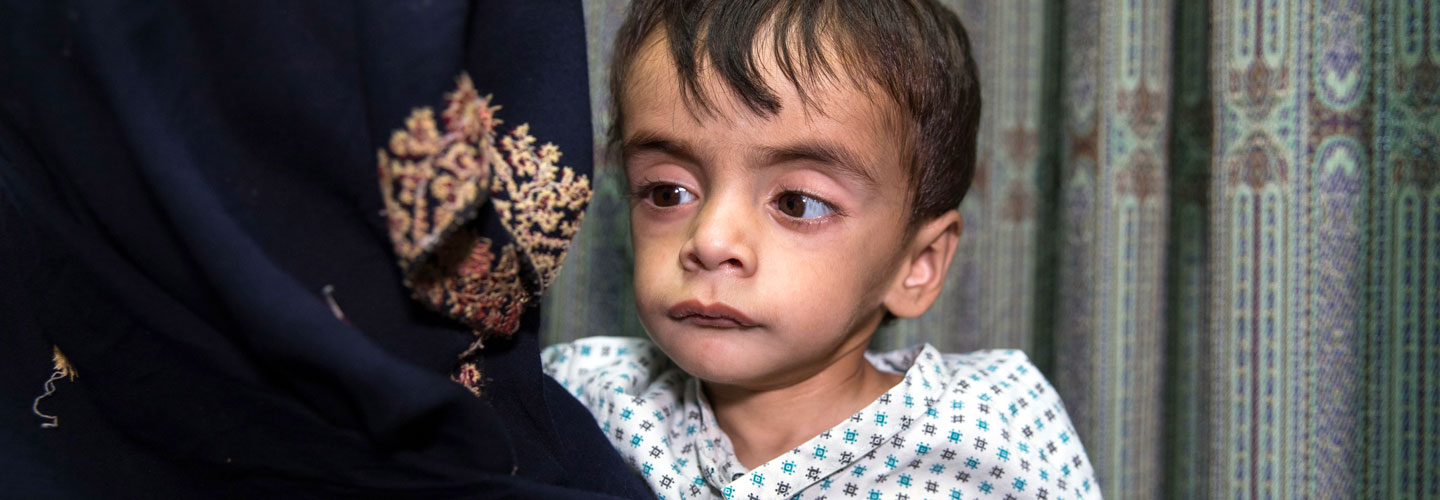 Enfant souffrant de malnutrition en Afghanistan avec sa mère