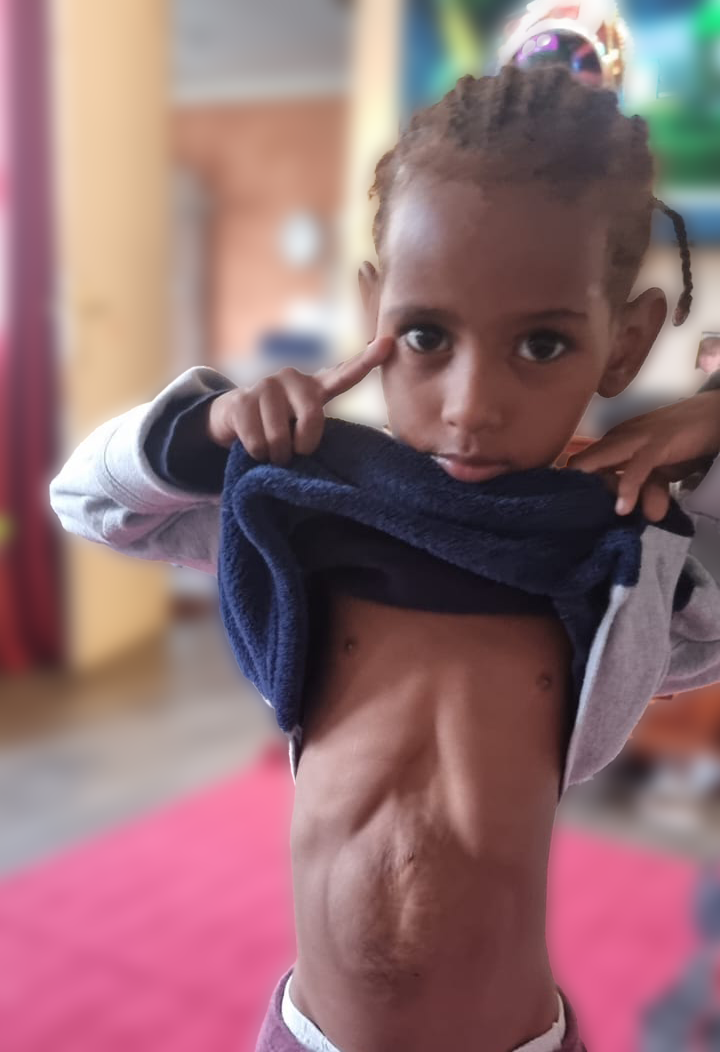 Mariela, open-heart surgery in Madagascar