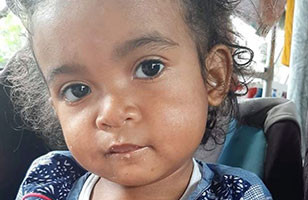 Mariela, open-heart surgery in Madagascar