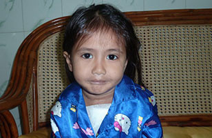 Mariela, open-heart surgery in Madagascar