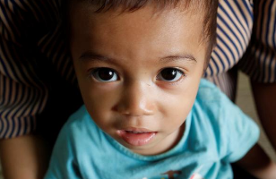 Mariela, open-heart surgery in Madagascar